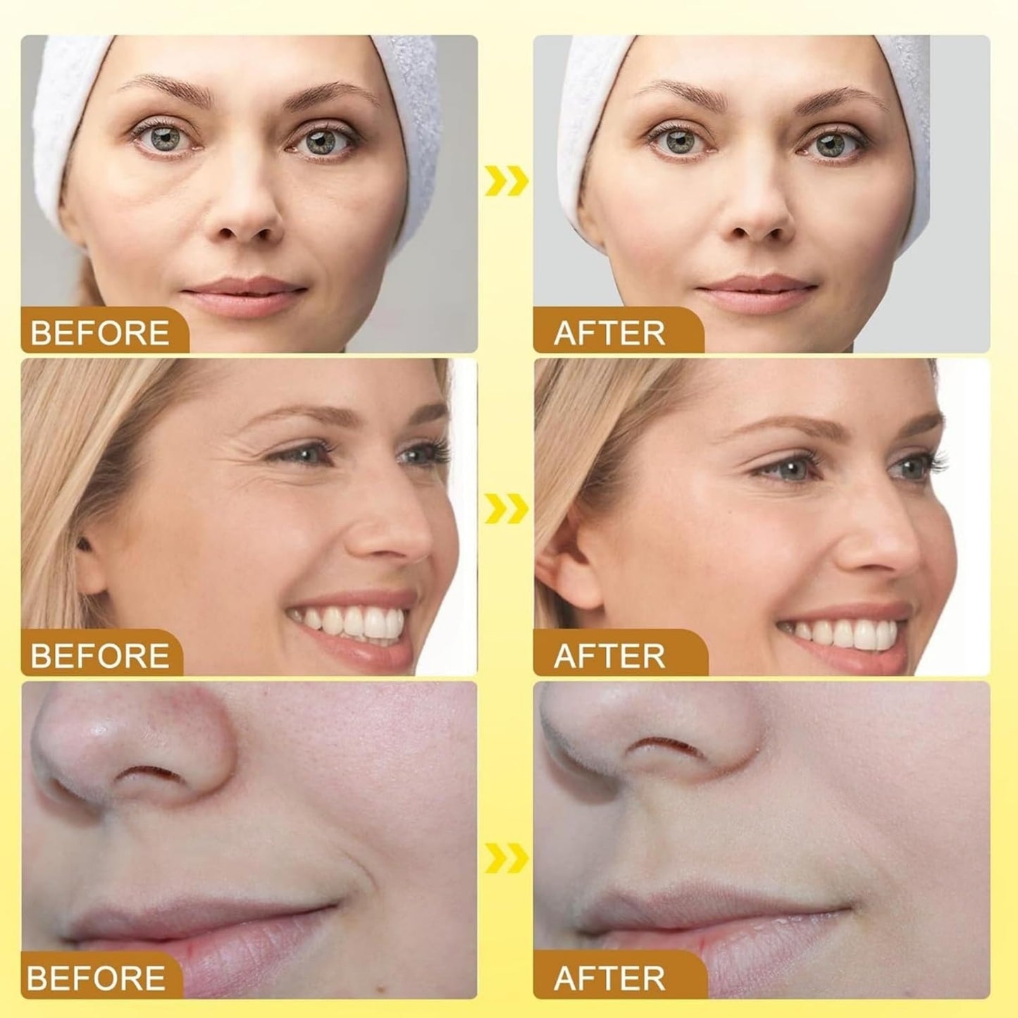 Botox Bee Venom Anti-Wrinkle Cream – Skin Tightening, Deep Hydration & Natural Glow Formula