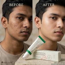 AXIS-Y Dark Spot Correcting Glow Serum – Niacinamide Brightening Facial Serum